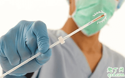 上完環月經變少了是咋回事 節育環放久了會月經不調嗎 3