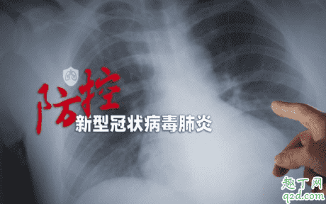 新冠肺炎潛伏期最長(zhǎng)24天真的假的 新型肺炎有超級(jí)傳播者嗎 2