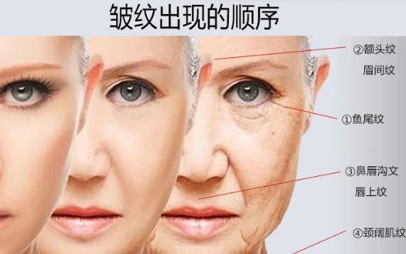 皺紋是怎么樣產生的呢？眼部皺紋怎樣減少?